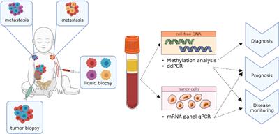 Case series on clinical applications of liquid biopsy in pediatric solid tumors: towards improved diagnostics and disease monitoring